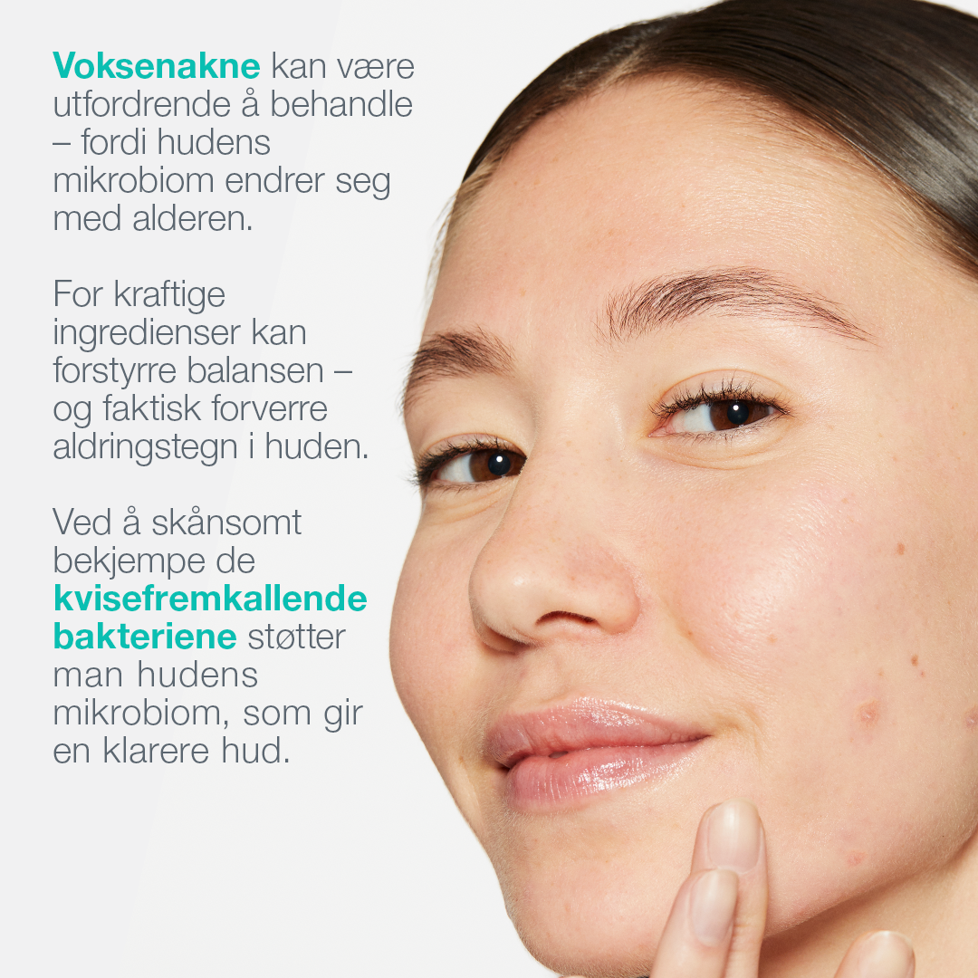 acne biotic moisturizer