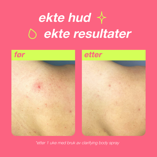 clarifying body spray