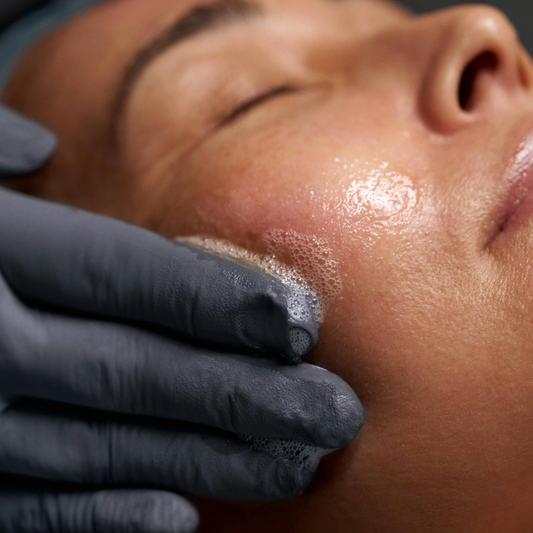 PRO-pakke til 12 Plump Peel-behandlinger