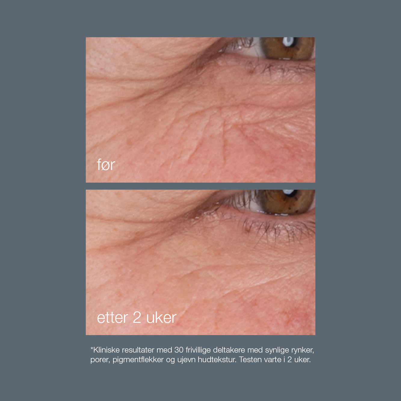 dynamic skin retinol serum