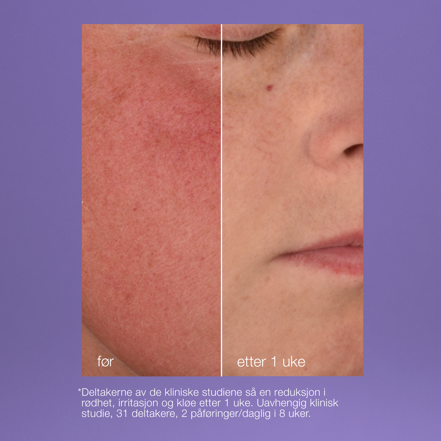 stabilizing repair cream