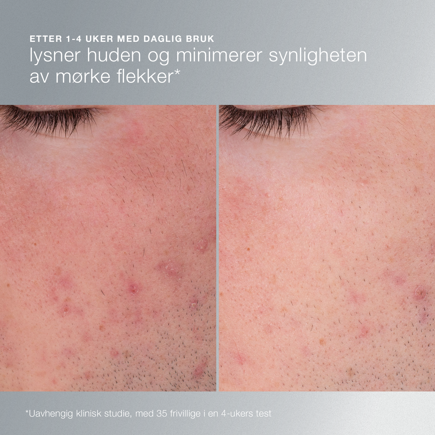reisestørrelse daily microfoliant pulverpeeling 13g