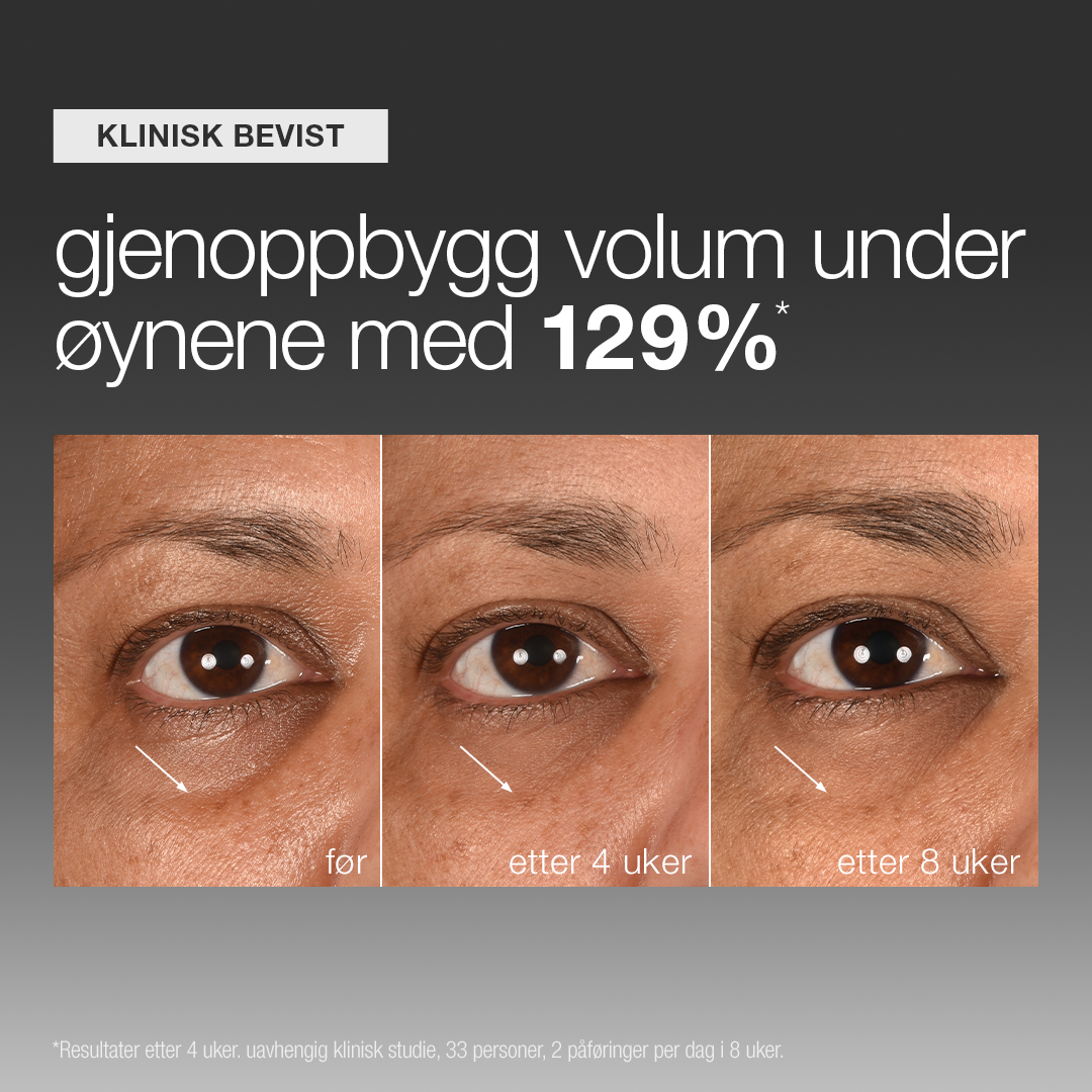 smart eye density serum