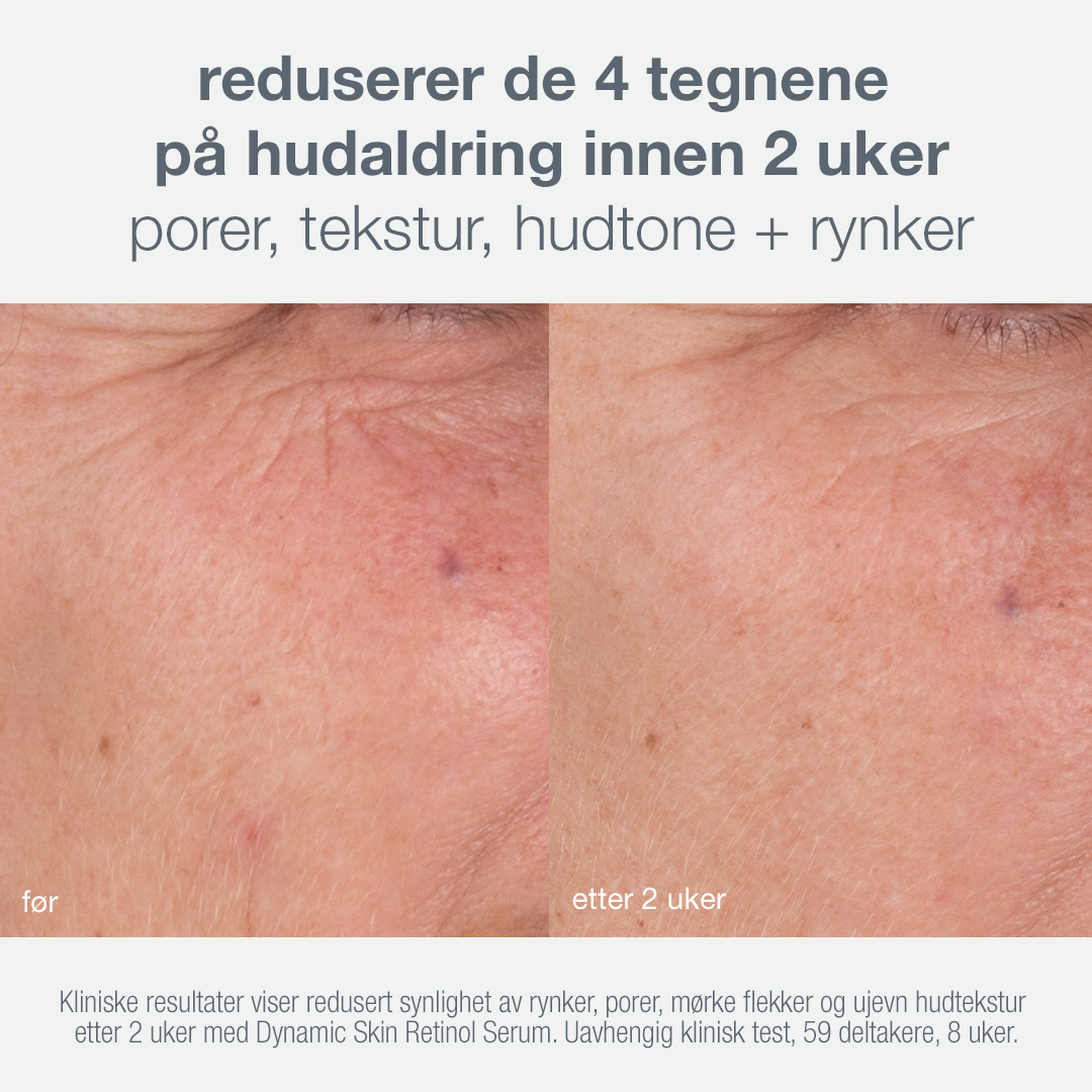 skin aging solutions skin kit