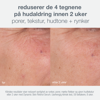 skin aging solutions skin kit