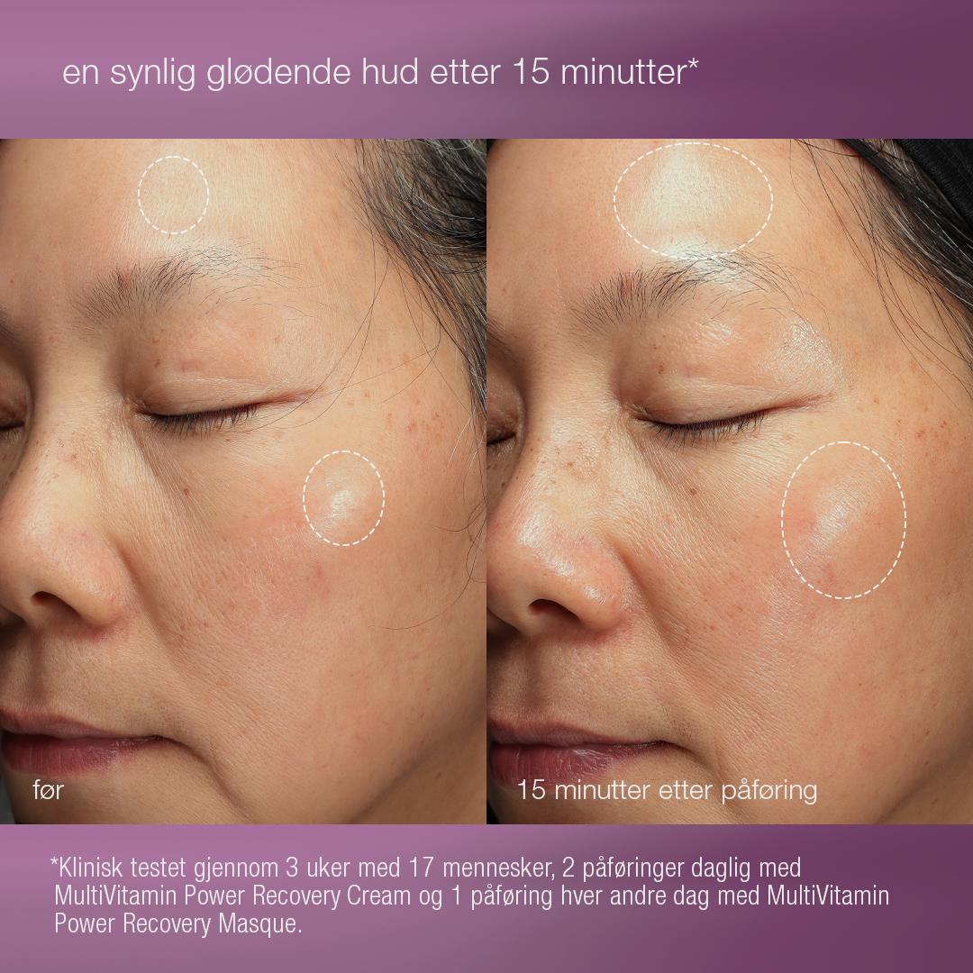 stressed skin recovery system