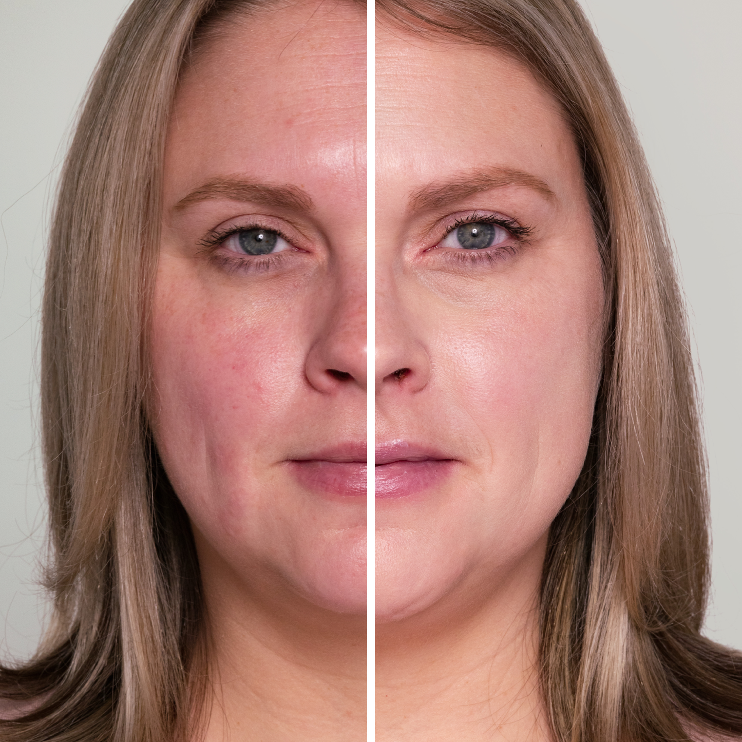 HydroPure™ Color Correcting Serum