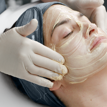 PRO melanopro peeling system 4PK