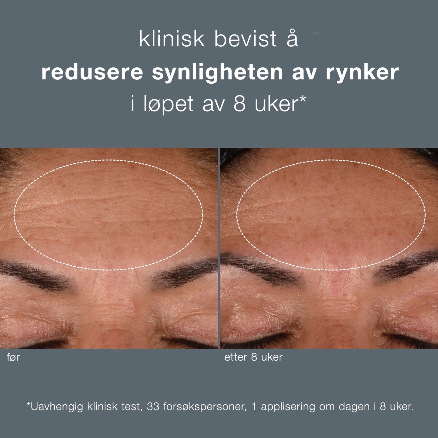 Reisestørrelse Dynamic Skin Recovery SPF50 12ml