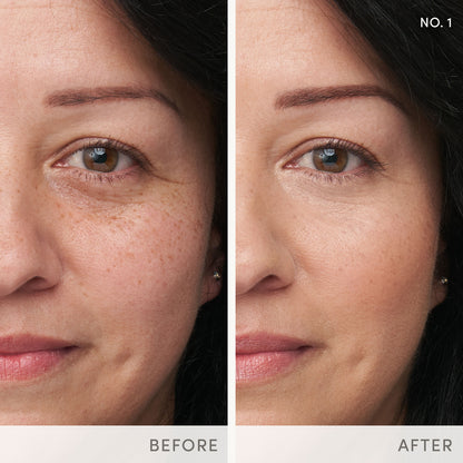 Enlighten Plus™ Under-eye Concealer