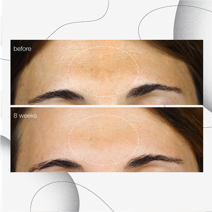 dermalogica powerbright dark spot serum før og etter 8 ukers bruk