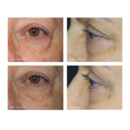 dermalogica awaken peptide eye gel før og etter